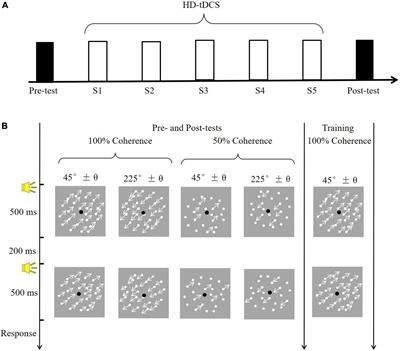 High-definition transcranial direct current stimulation of the left middle temporal complex does not affect visual motion perception learning